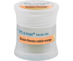 IPS e.max Ceram Art